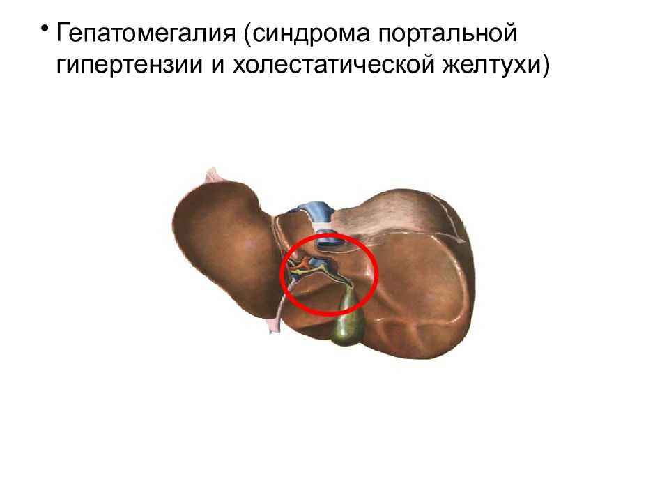Стеатоз печени и поджелудочной железы. здоровье печени