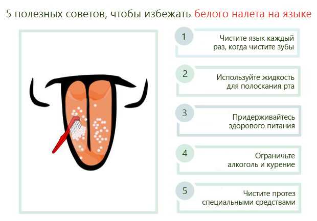 Географический язык у ребенка - симптомы болезни, профилактика и лечение географического языка у ребенка, причины заболевания и его диагностика на eurolab