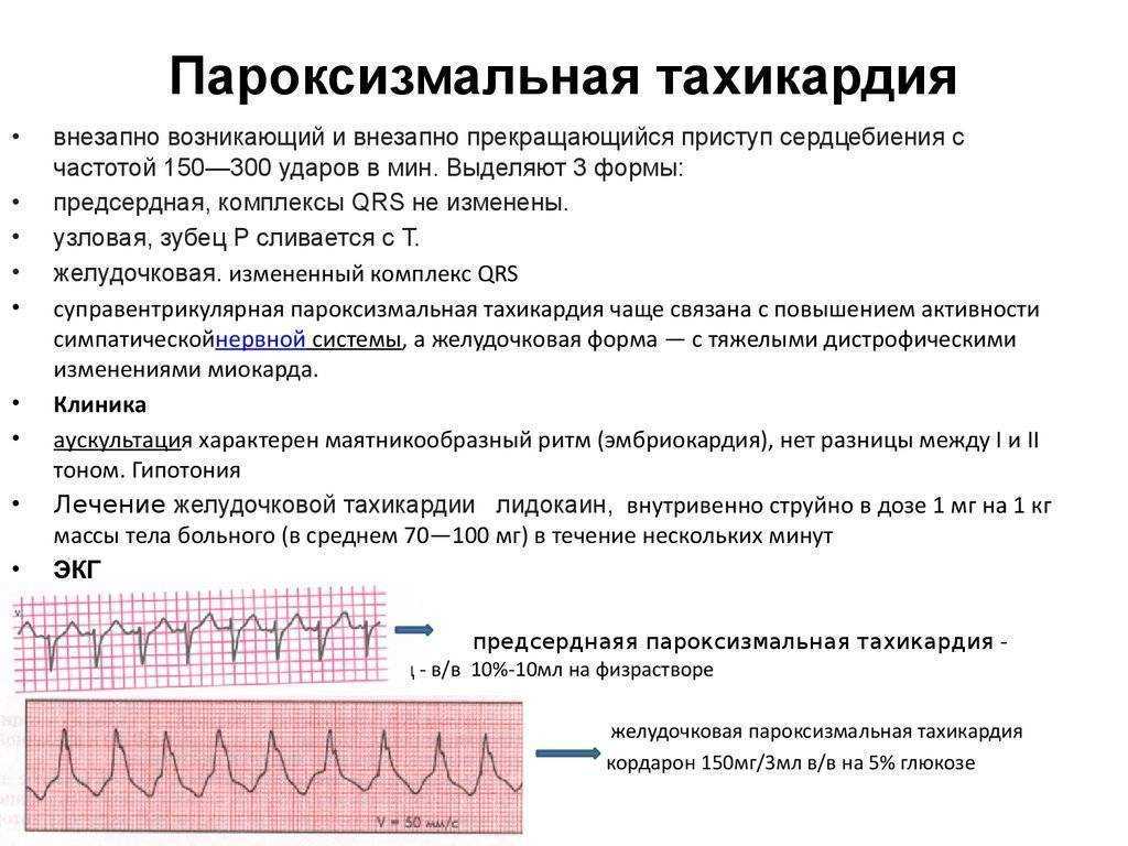 Учащенное сердцебиение у детей