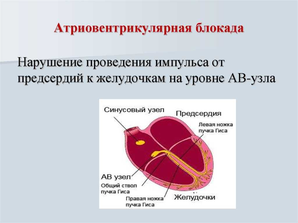 Изменения на экг при сердечных блокадах | университетская клиника