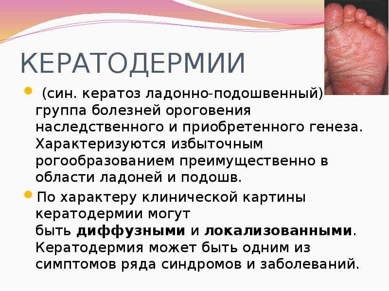 Симптомы, причины и виды атрофии головного мозга - кортикальная, мультисистемная и другие виды атрофии