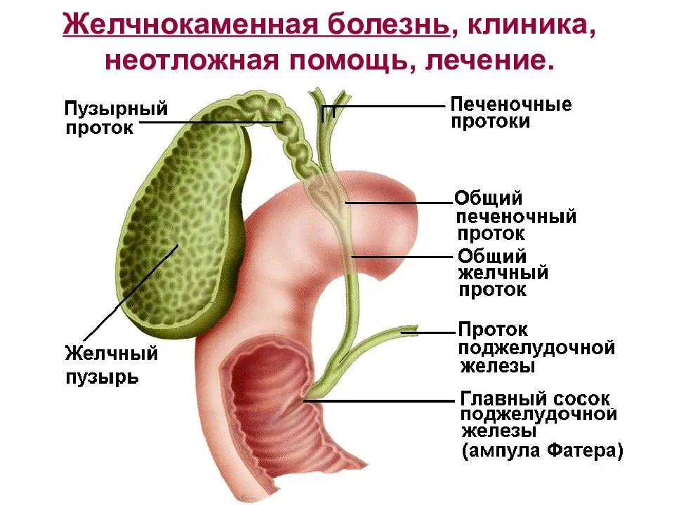 Клиническая картина жкб