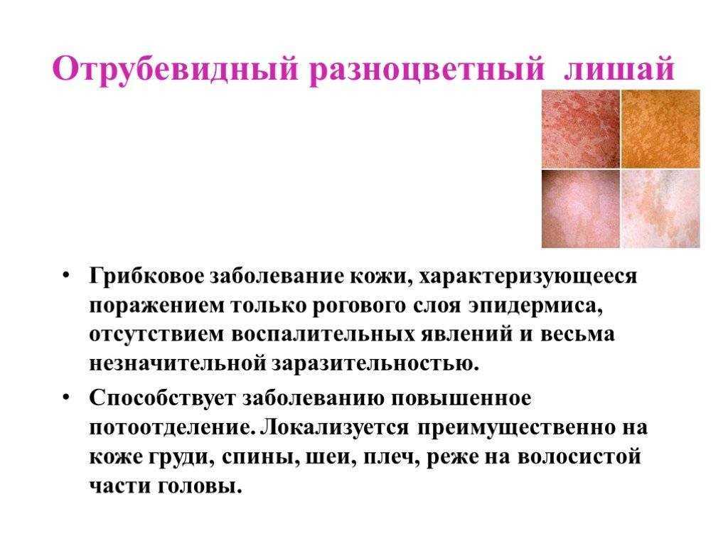 Красный плоский лишай
