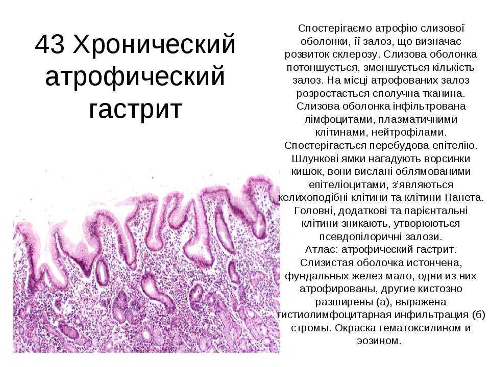 Гастрит: признаки, симптомы и диагностика | клиника «наедине»