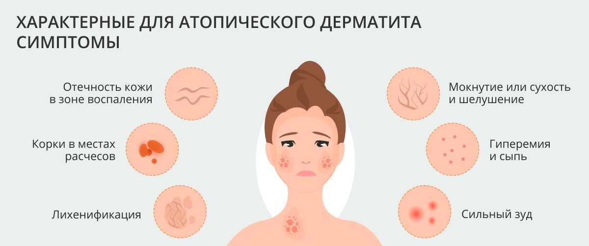Пиодермия