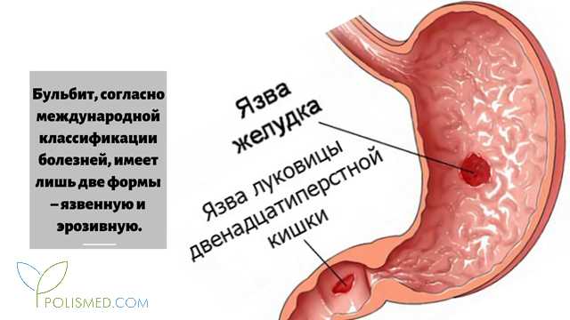 Лечебная диета №1: меню, продукты, рецепты | food and health