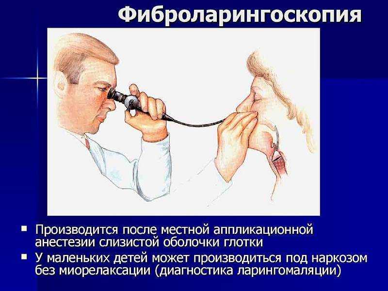 Трахеит у взрослых