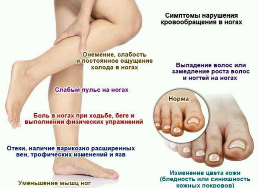 Гангрена