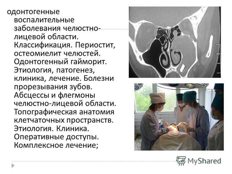 Периренальный (околопочечный) абсцесс - характеристика, факторы риска, симптомы, осложнения. часть 1 | университетская клиника