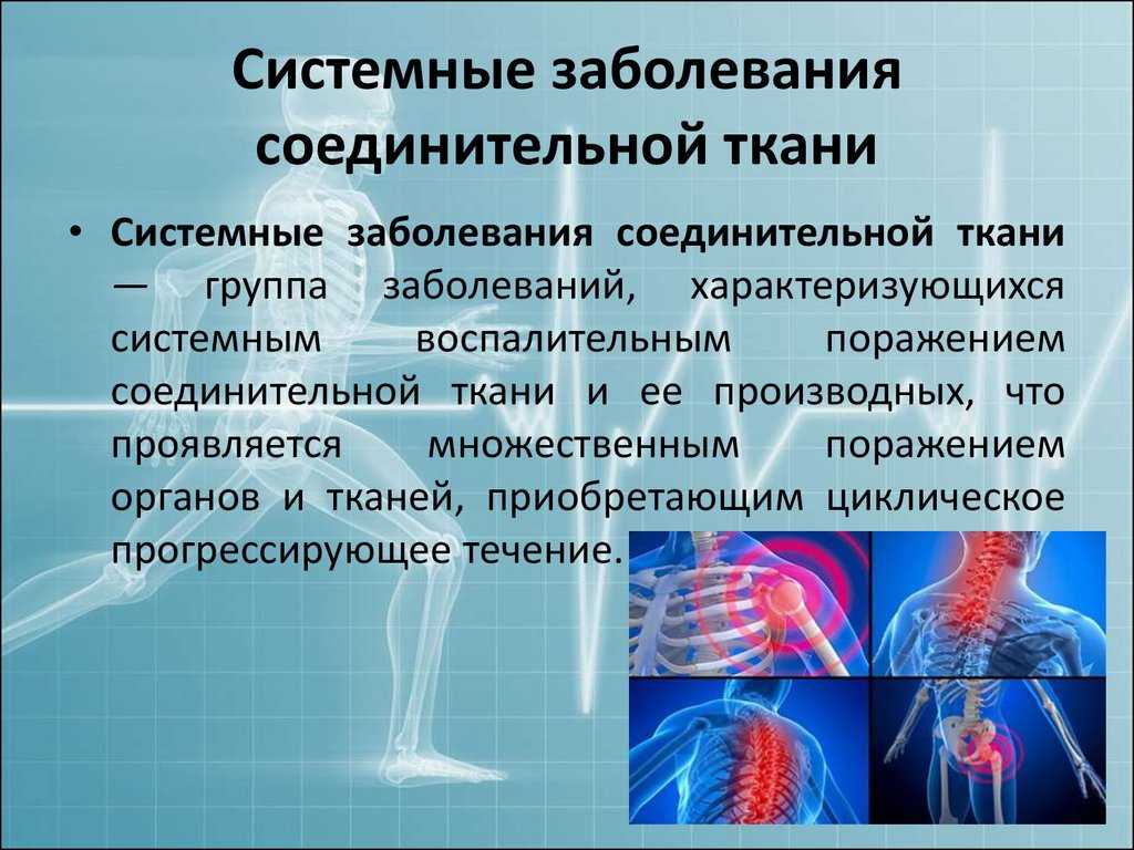 Системная склеродермия: современные аспекты проблемы