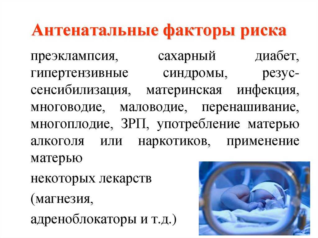 Мертворождение и его причины
