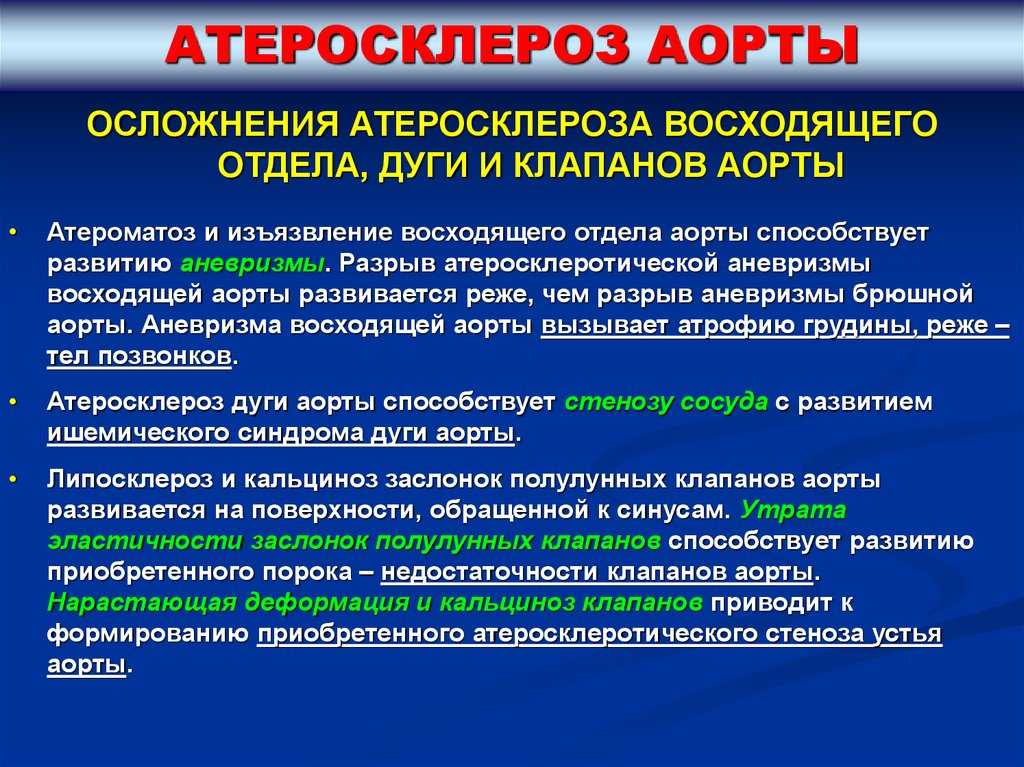 Аневризма аорты