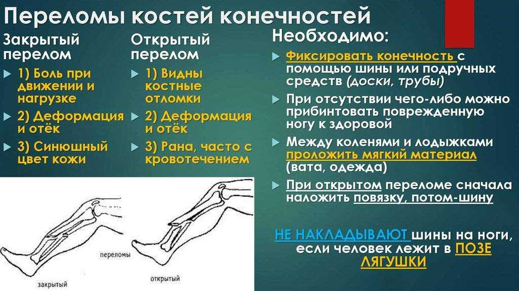 Переломы костей: общие сведения | eurolab | травматология