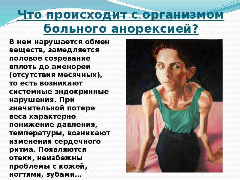 Анорексия – описание и классификация (истинная, нервная), причины и признаки, стадии, лечение, книги про анорексию, фото больных