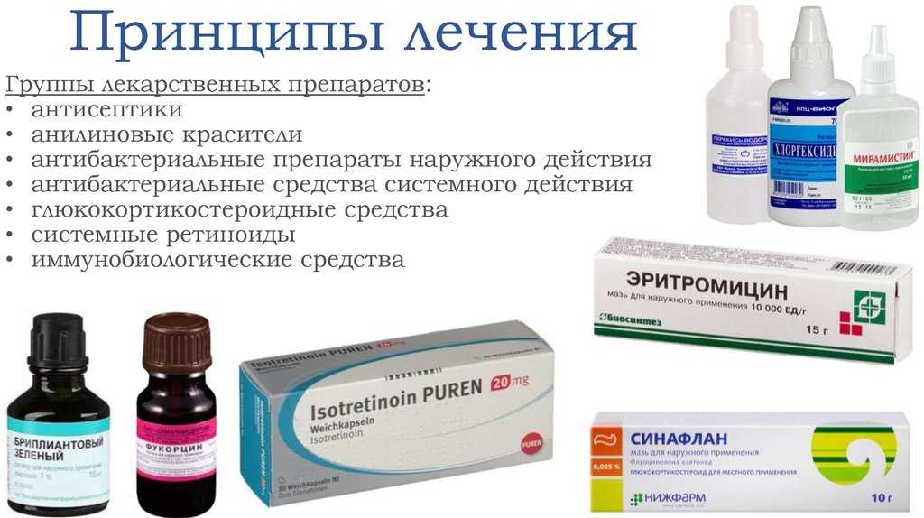 Пиодермия: типы, диагностика, лечение, препараты