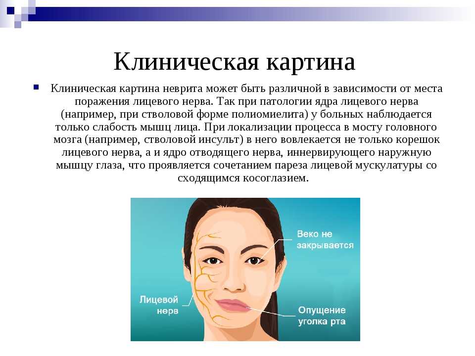 Причины онемения рук и ног