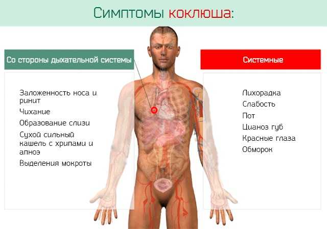 Коклюш