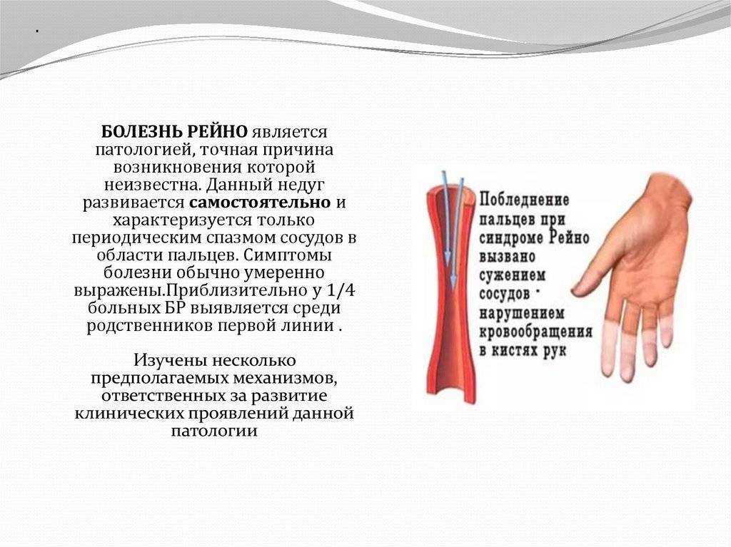 Поражение мозга