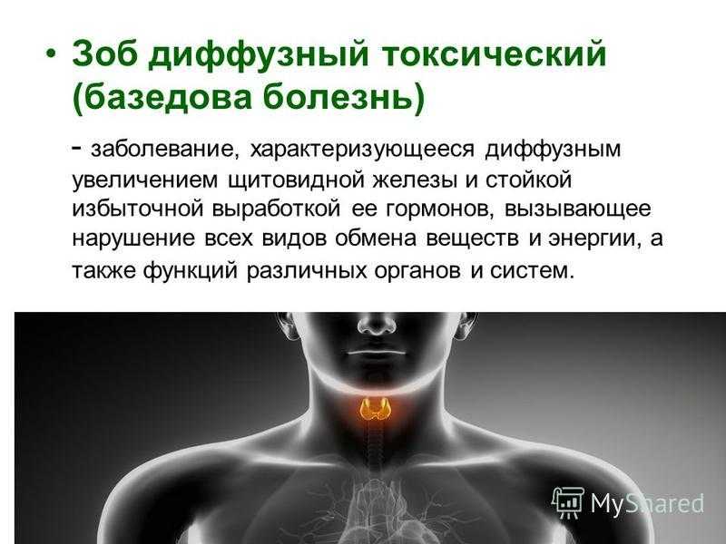 Зобом является. Эндемический зоб и базедова болезнь. Диффузия зоба щитовидной железы. Эндемический зоб гипофункция щитовидной железы. Токсический зоб базедова болезнь.
