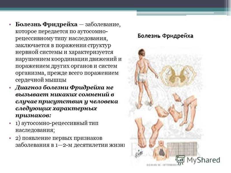 Симптомы и лечение атаксии фридрейха - medside.ru