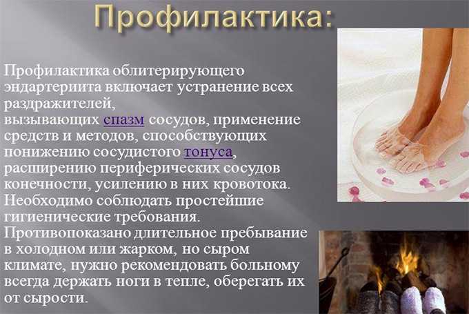 Лечение атеросклероза артерий
