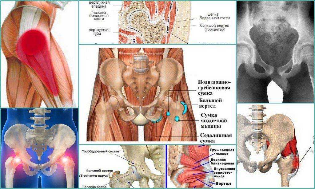 Вертел тазобедренного сустава картинка