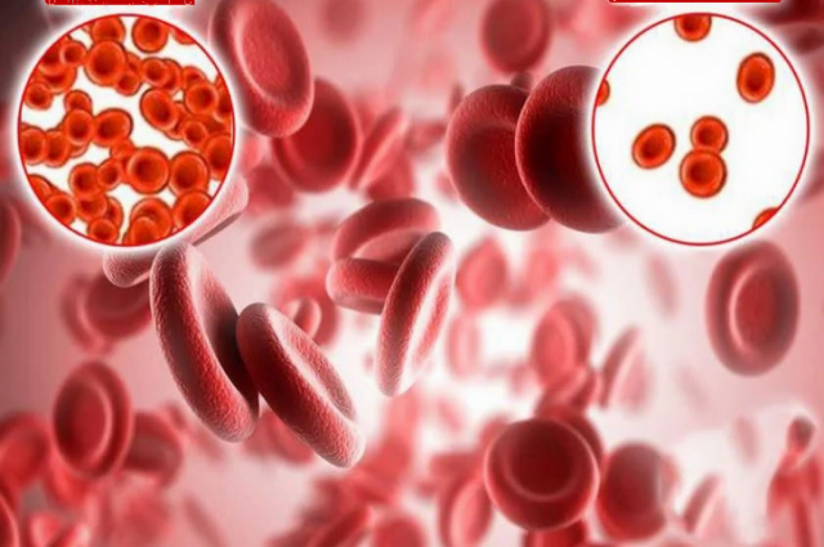 Снижение гемоглобина у мужчин. Fufvfvbz. Анемия картинки. Железодефицитная анемия кровь.