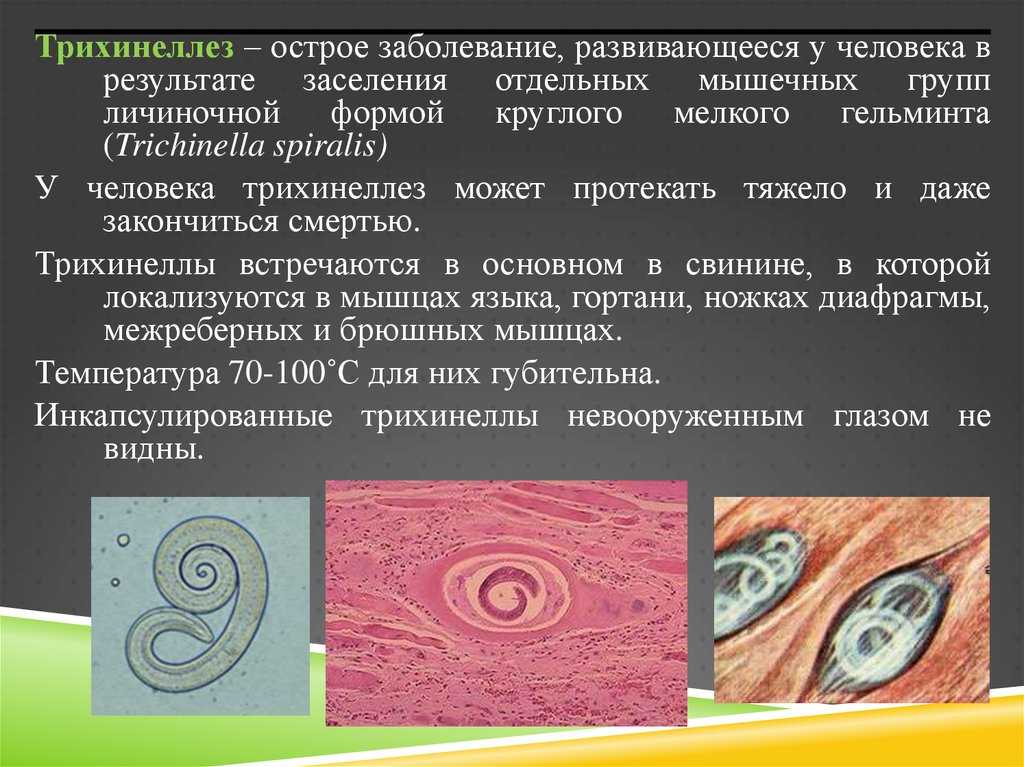 Трихинеллез: симптомы у человека, лечение - medside.ru