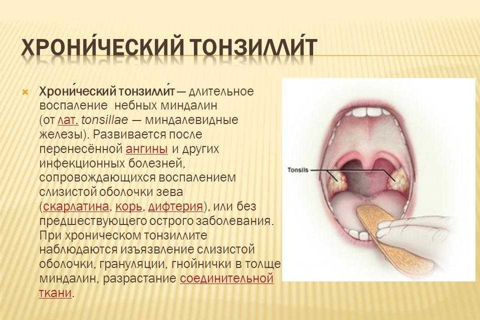 ᐈ острые инфекции нижних дыхательных путей ~【киев】