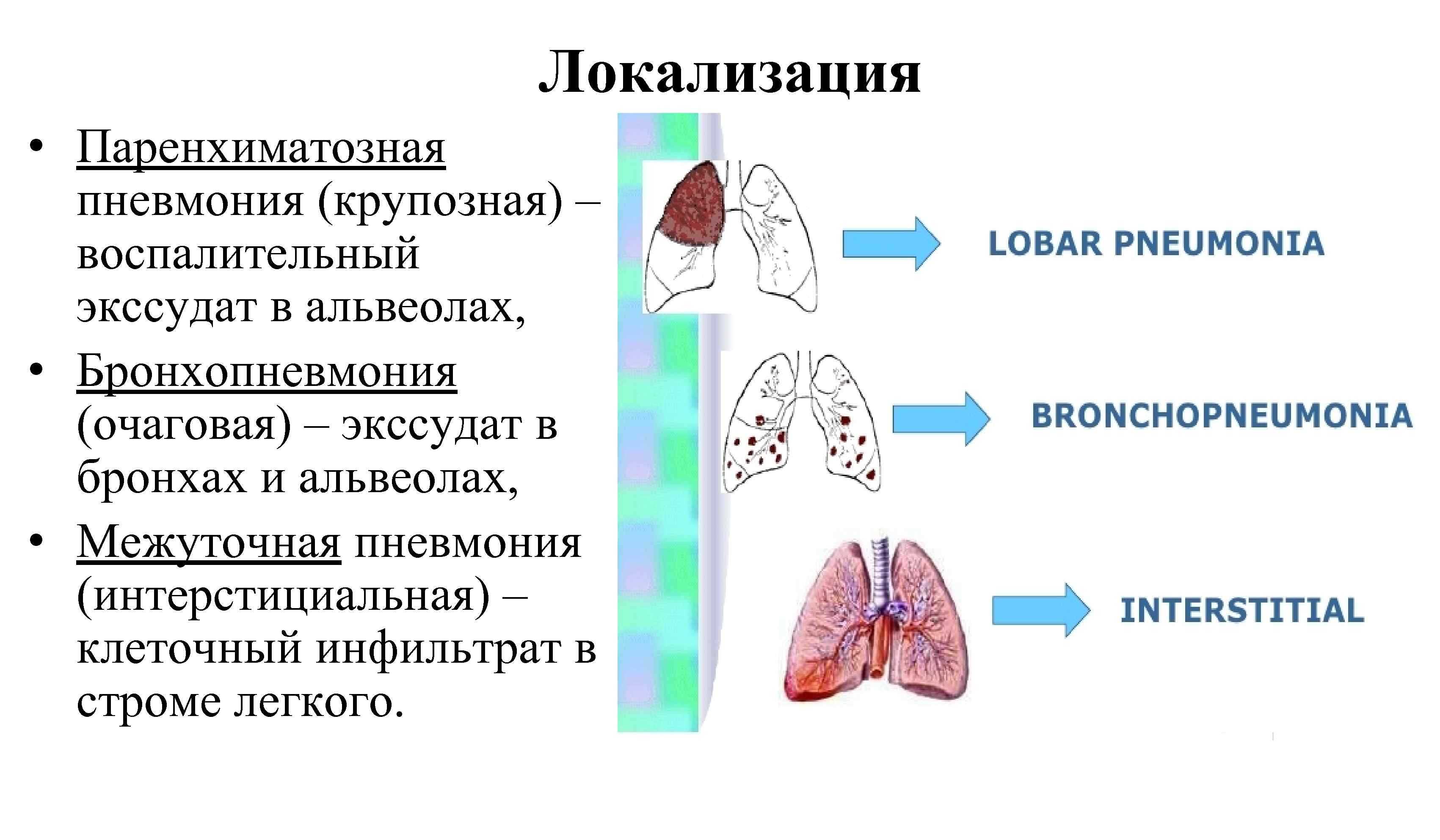 Наиболее возможная аускультативная картина легких при очаговой пневмонии