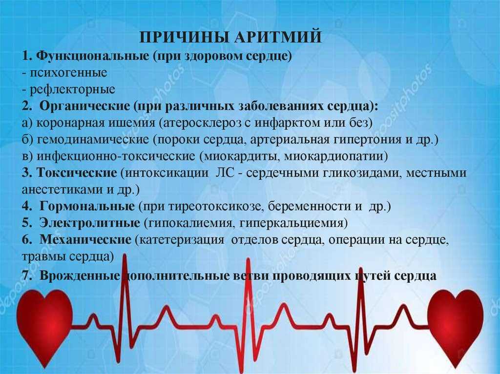 Реваскуляризация миокарда: цель, способы – традиционные и современные, как проводится