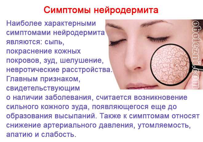 Эритема и ангионеврозы кожи