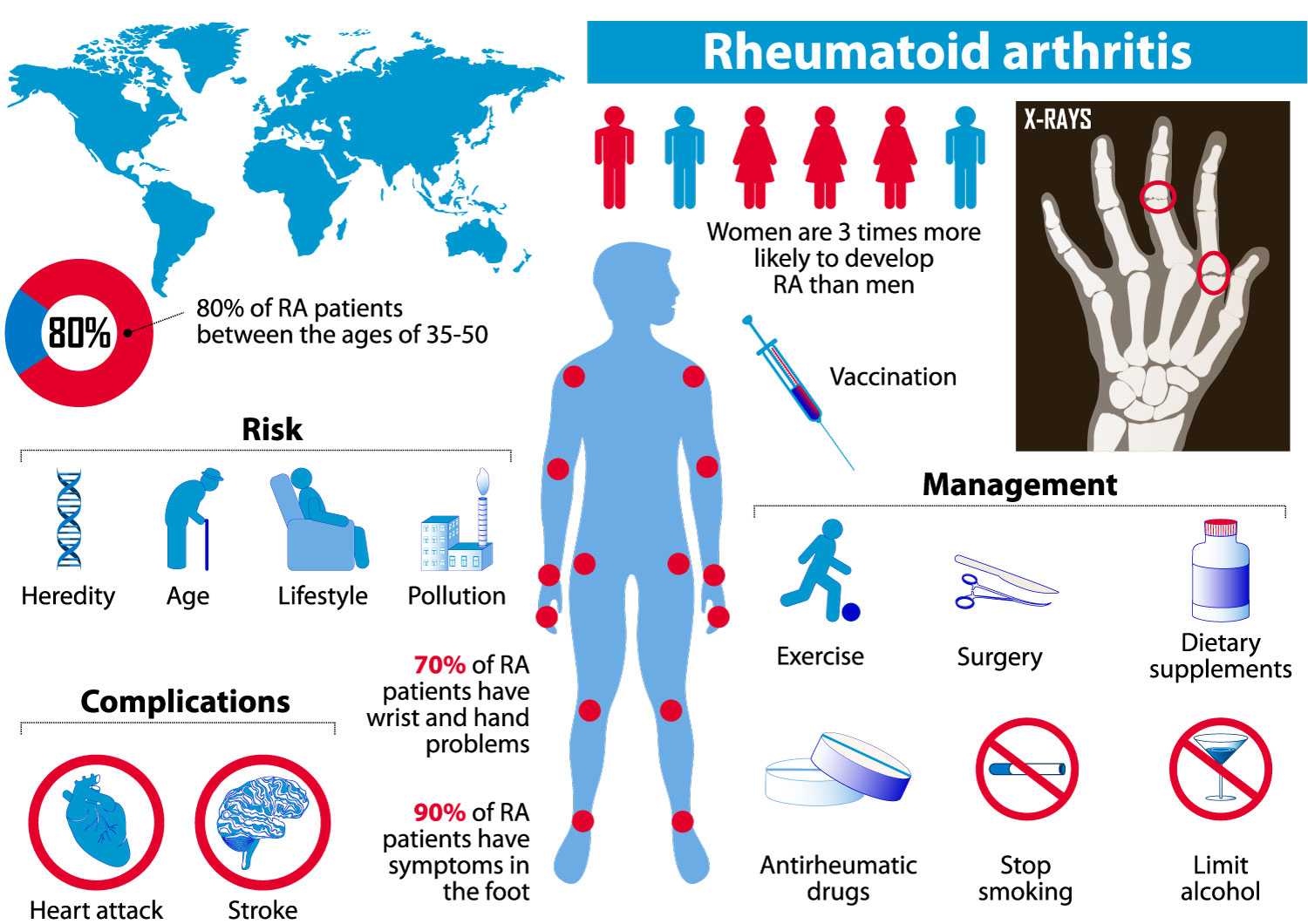 Список анализов для диагностики ревматоидного артрита
