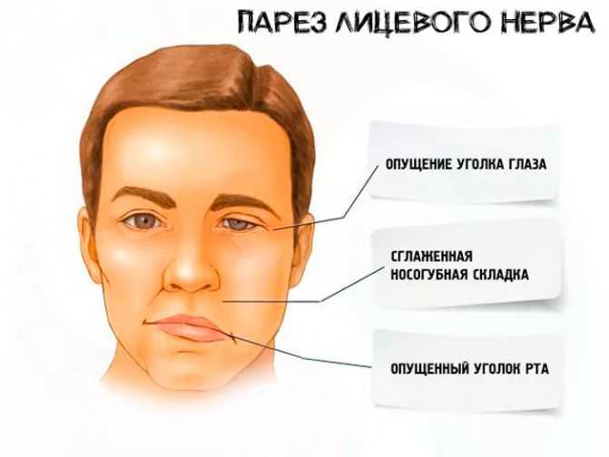 Нарушение функции органов, двигательные расстройства при болезнях нервной системы - медицинский центр «эхинацея»