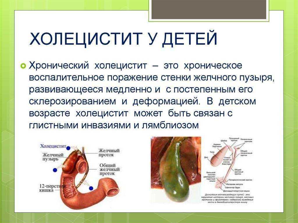 Полип желчного пузыря: виды и опасность, методики лечения – эл клиника