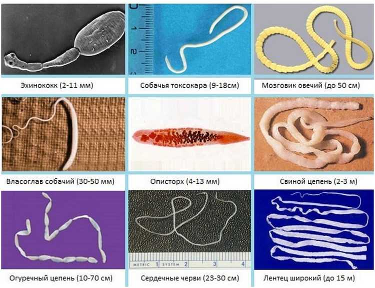 Виды гельминтов у человека картинки