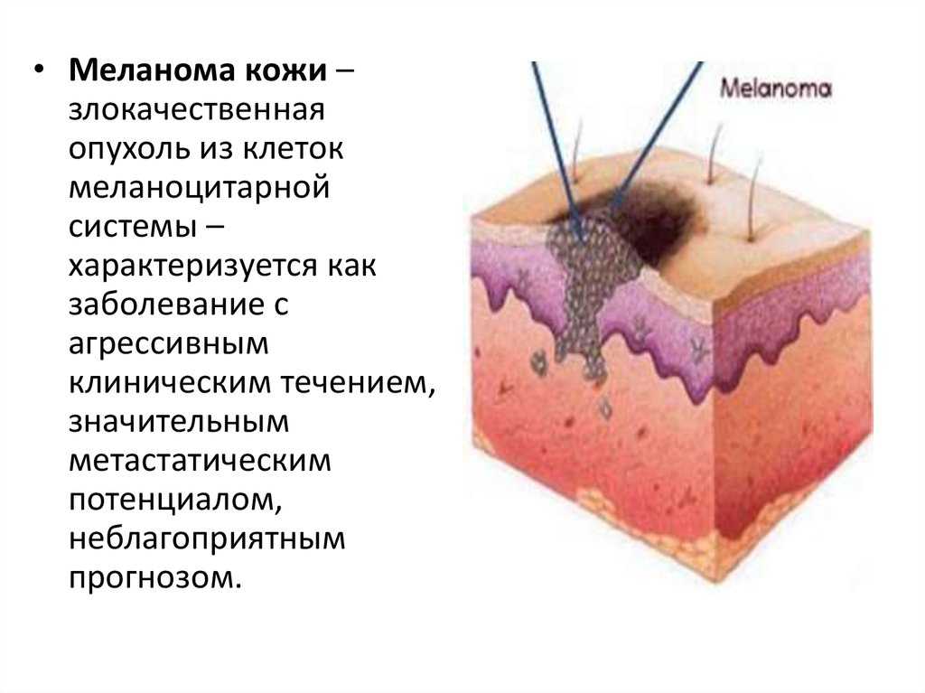 Меланом таблетки