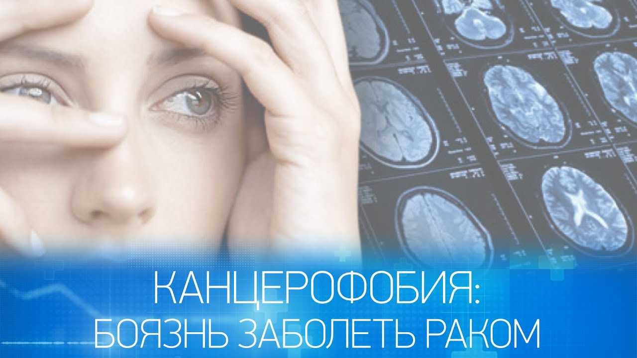 Социофобия это - причины, симптомы, признаки, стадии, последствия, лечение | rehab family