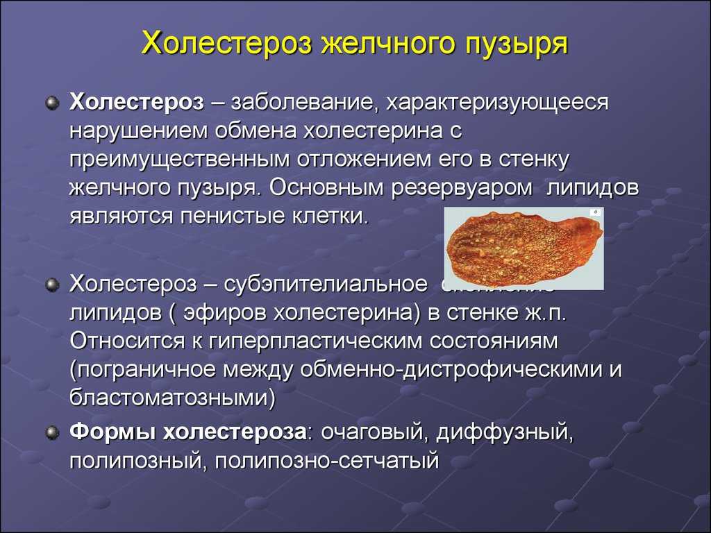 Холецистит: что это за болезнь, симптомы, причины и лечение у взрослых