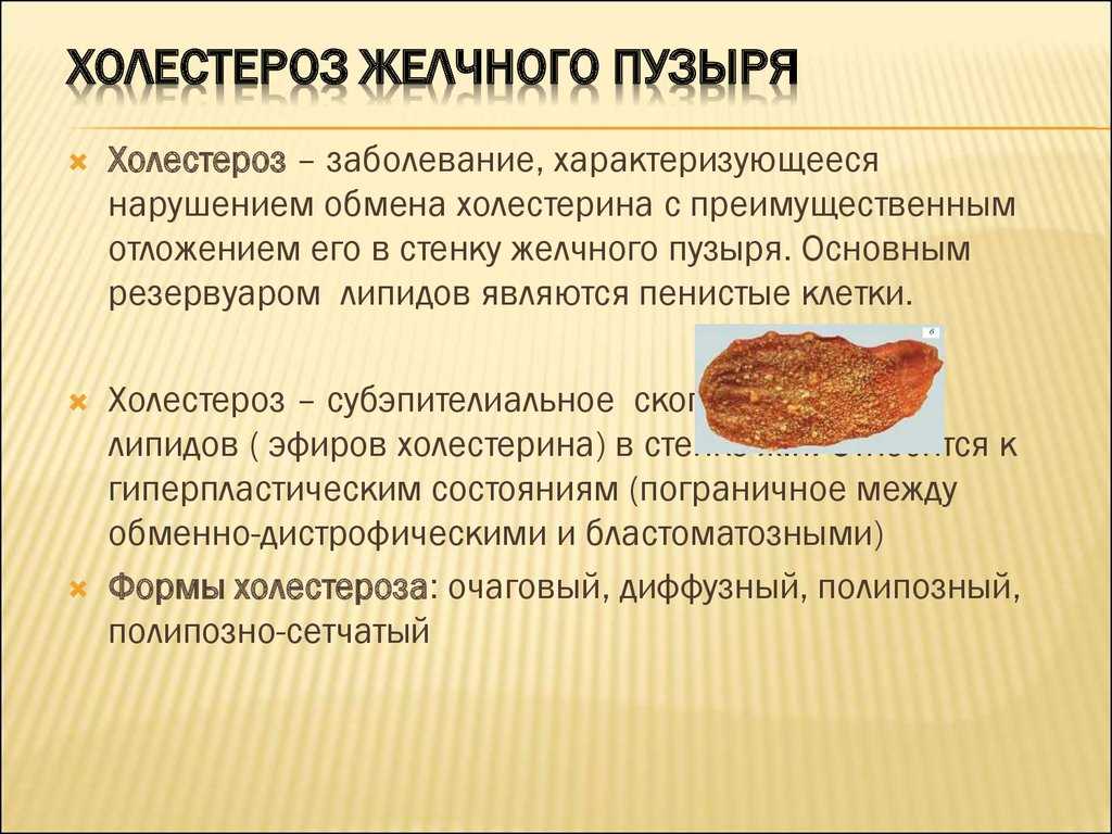 Холестероз желчного пузыря относится к заболеваниям нарушения обмена холестерина Неоднократными исследованиями установлена частота сочетания этого заболевания с атерогенной дислипидемией — у больных отмечалось повышение