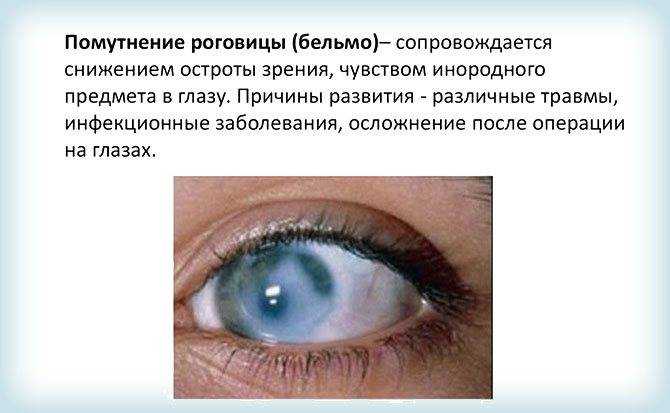Атрофические изменения головного мозга