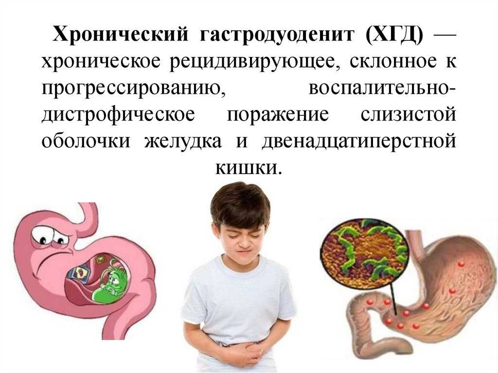 Диета при гастрите