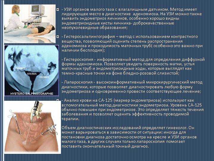 Эндометриоз: как выявить и вылечить опасную болезнь