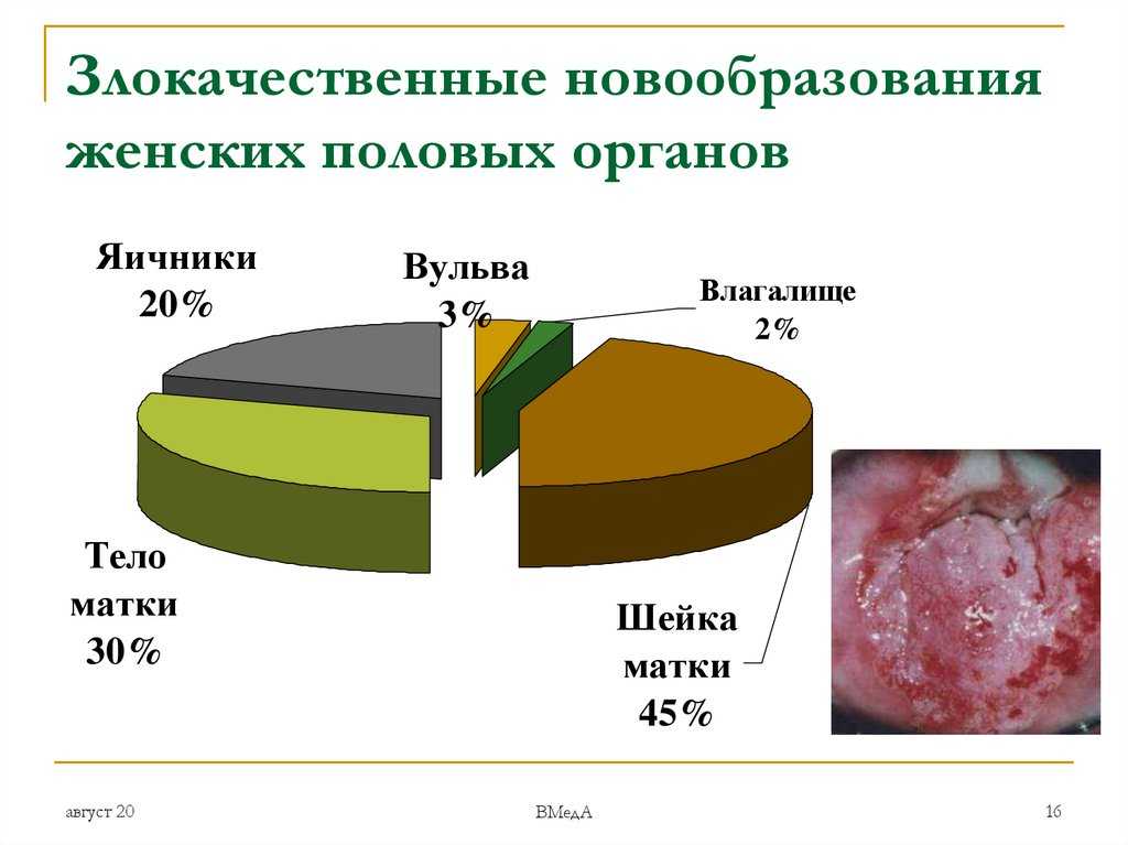 Диета после операции по удалению матки, разрешенные и запрещенные продукты