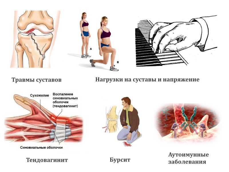 Доброкачественные и злокачественные опухоли: отличия, признаки, виды и характеристики, диагностика новообразований
