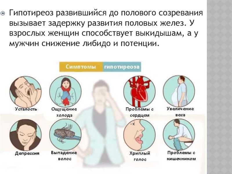 Диффузный токсический зоб
