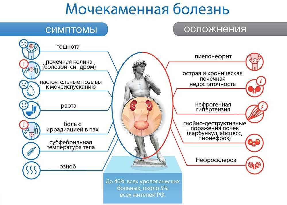 Почечная колика