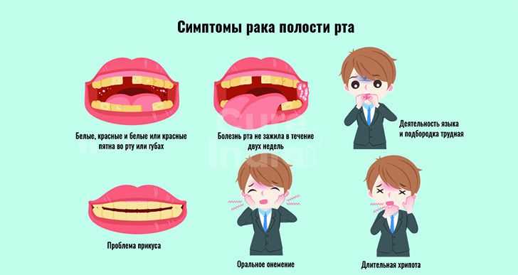 Рак губы - признаки, причины, симптомы, лечение и профилактика - idoctor.kz