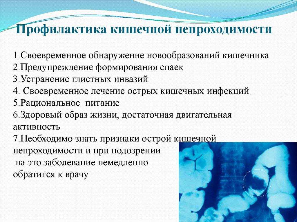 Первая помощь при кишечной непроходимости