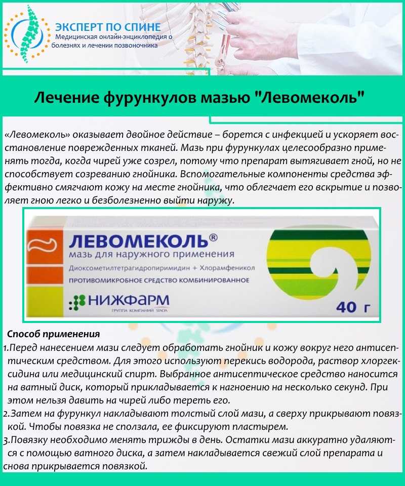 Лечение фурункулеза: причины и профилактика